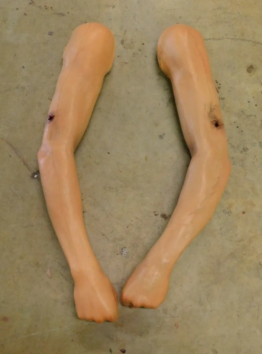 Dura Martin Arm with Gunshot Through and Through